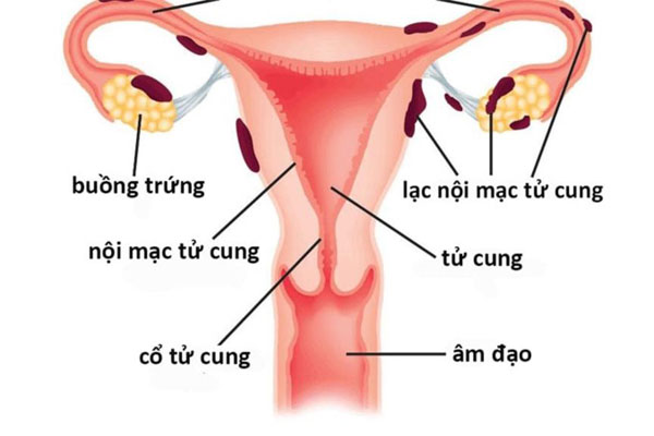 Trong cơ thể người phụ nữ, tinh trùng chỉ có thể tồn tại trong khoảng 3 ngày.